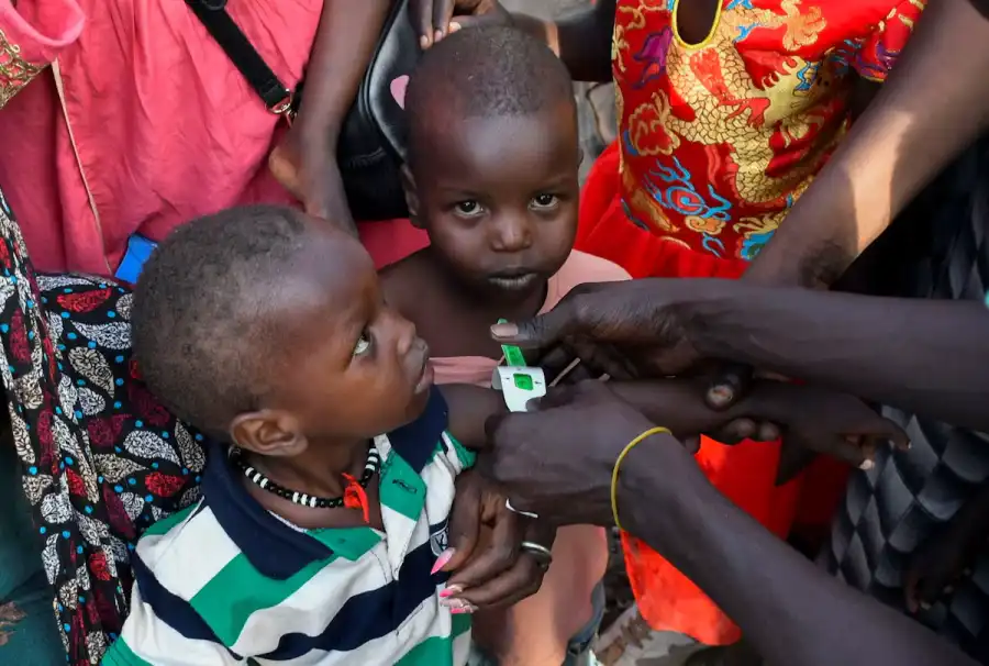 Children are examined for malnutrition as civilians who fled the war torn Sudan